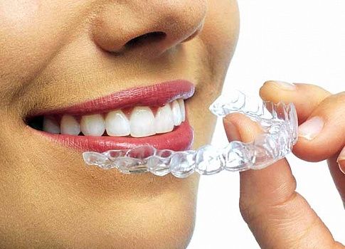 Как отбелить зубы в домашних условиях?