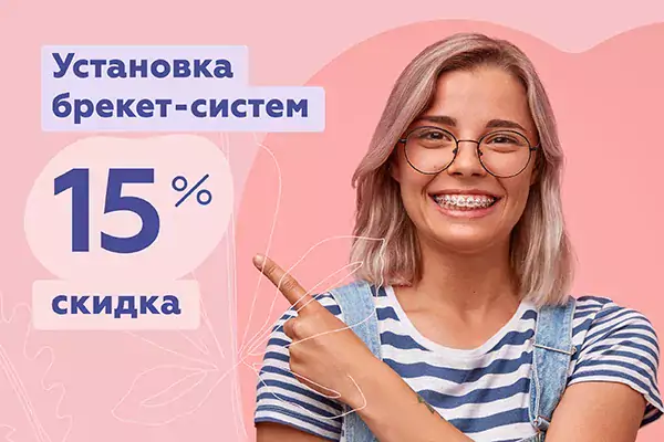 Скидка 15% на установку брекет-систем!