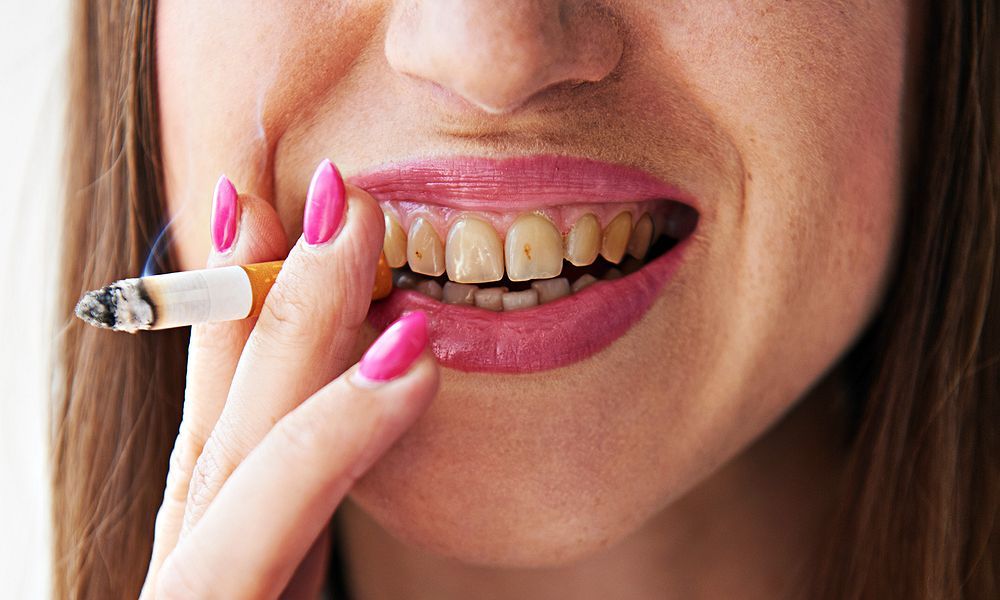 Желтые зубы — 10 причин пожелтения эмали 