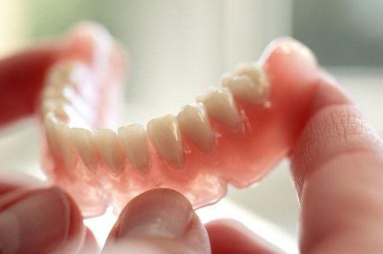 Протезирование зубов. Съемные или несъемные протезы – что лучше?