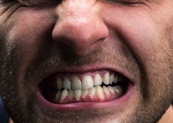 Бруксизм — непроизвольный скрежет зубами