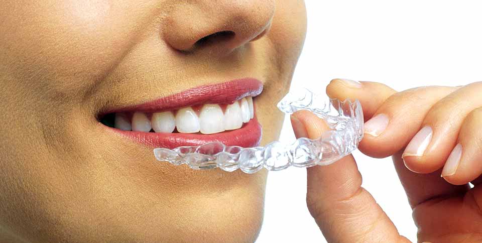 Как отбелить зубы народными способами?