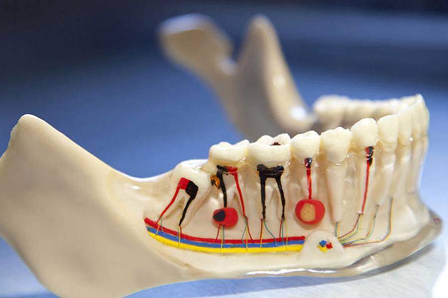 Почему зуб болит после пломбирования: причины и способы лечения