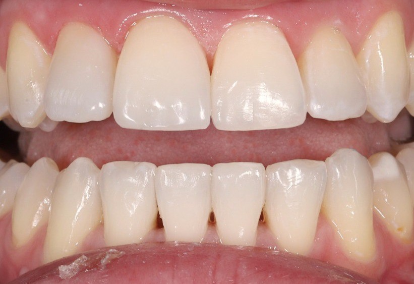 Реставрация зубов (Скибинская Е.В.)
