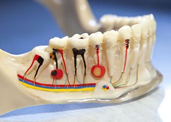 Болит зуб после пломбирования каналов — 5 причин боли