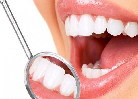 Профилактика кариеса зубов -  спасет ли полностью от кариеса?