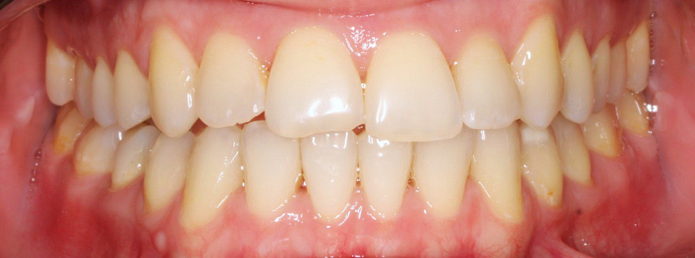 Реставрация зубов (Скибинская Е.В.)