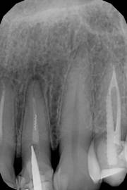 снимок нескольких зубов